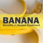 Banana Benefits in Herpes Treatments
