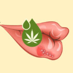 CBD_cannabis_Herpes
