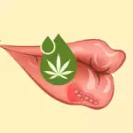 CBD_cannabis_Herpes