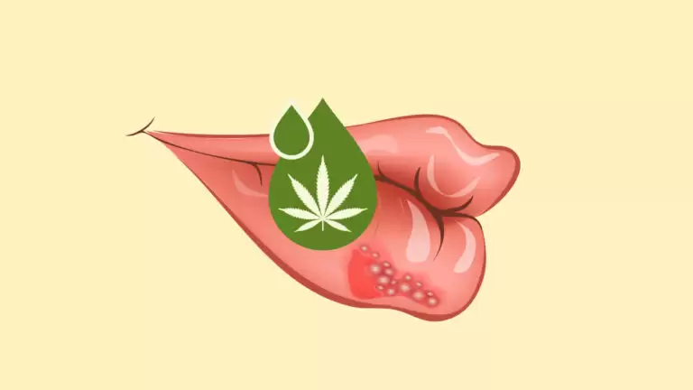 CBD_cannabis_Herpes