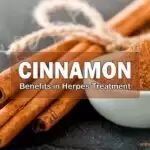 Cinnamon, Benefits in Herpes Treatment