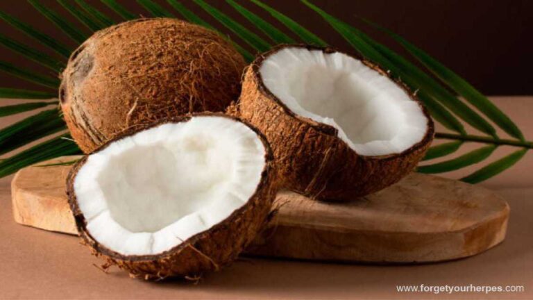 Coconut Benefits in Herpes Treatment