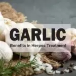 Garlic, Benefits in Herpes Treatment