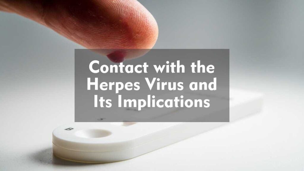 Contact with the Herpes Virus and Its Implications